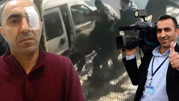 Kameraman Ercan Yüksel'i kör eden trafik magandalarına 6 yıla kadar hapis istendi