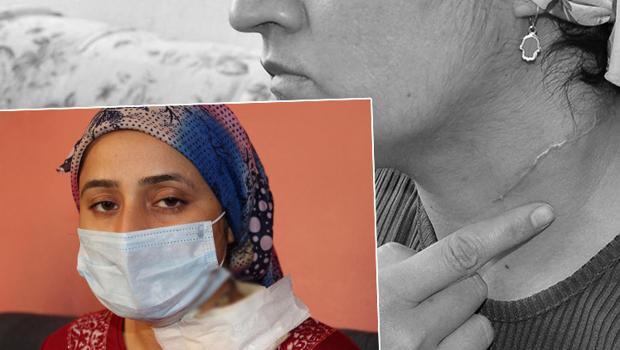 Manisa'da eşinin boğazını falçatayla kesen eşe 'iyi hal' indirimi