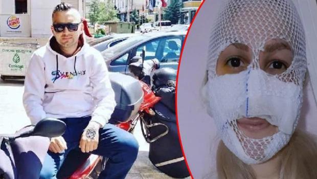 Sultan'ın yüzüne kimyasal madde atmıştı! Yakalanan zanlı tutuklandı