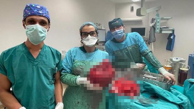 Ağrı şikayetiyle gitti, karnından 6 kilo ağırlığında kitle çıkarıldı