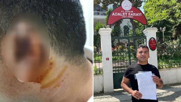 İnanılmaz olay! Kavgada ısırılarak koparılan kulağını martı kaptı