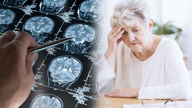 Tek belirtisi unutkanlık değil! Bu davranış değişiklikleri Alzheimer'a işaret ediyor