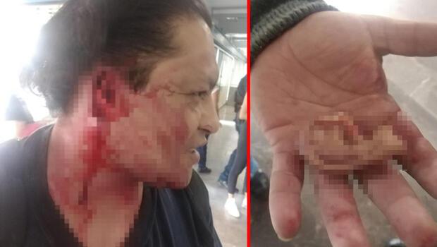 Meksika'da akılalmaz olay! Metroda kavga ettiği adamın kulağını koparttı
