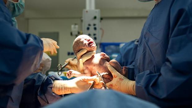 Doktorlar anne karnında öldüğünü söylediler, canlı olarak dünyaya geldi! 