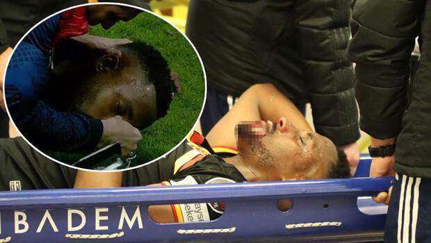 Kayserispor-Fenerbahçe maçında talihsiz sakatlık! Carole baygınlık geçirdi, hastaneye kaldırıldı