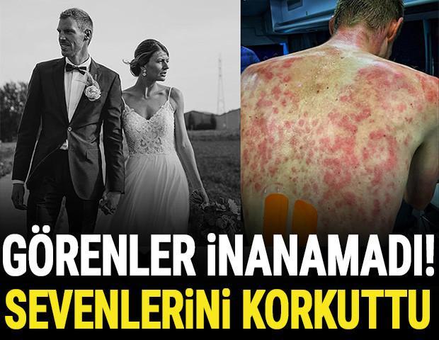 Son Dakika | Dolu fırtınasına yakalanan Tim Declerqin son hali şoke etti