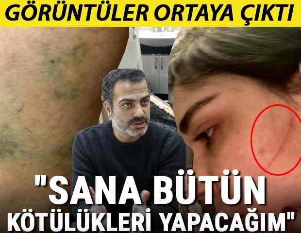 Son dakika haberi... Sermiyan Midyat ve eski sevgilisi Sevcan Yaşar arasında neler yaşandı Kavganın görüntüleri ortaya çıktı...