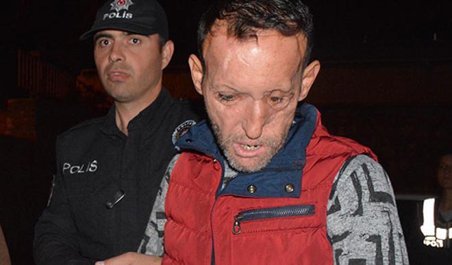 Yüz nakli olan Recep Sert tutuklanmıştı! Soruşturmada yeni gelişme Yüz nakli olan Recep Sert tutuklanmıştı! Soruşturmada yeni gelişme
