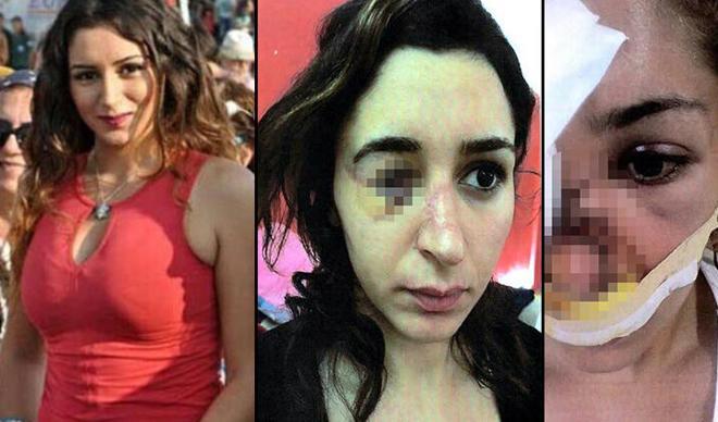 Genç kadın kâbusu yaşamıştı! İstenen ceza belli oldu Genç kadın kâbusu yaşamıştı! İstenen ceza belli oldu