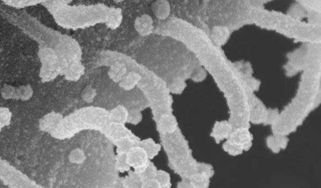 Koronavirüs hücresinin yeni fotoğrafı ortaya çıktı Koronavirüs hücresinin yeni fotoğrafı ortaya çıktı