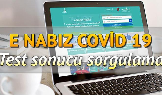 Koronavirüs (coronavirüs) test sonucu kaç günde çıkar? e-Nabız Covid 19 test sonucu sorgulama ekranı ve e Nabız girişi Koronavirüs (coronavirüs) test sonucu kaç günde çıkar? e-Nabız Covid 19 test sonucu sorgulama ekranı ve e Nabız girişi