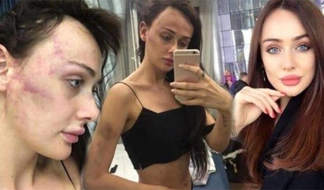 Sırp modele dehşeti yaşatmıştı! '112'yi aradım' demişti ama... Sırp modele dehşeti yaşatmıştı! '112'yi aradım' demişti ama...