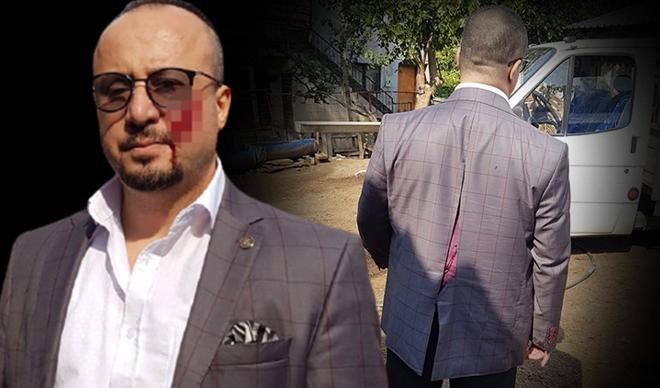 Avukat neye uğradığını şaşırdı! İşte yanağını ısıran sanığın cezası Avukat neye uğradığını şaşırdı! İşte yanağını ısıran sanığın cezası