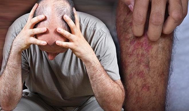 Covid-19’un az bilinen yan etkileri... Akciğer ve böbrekler dışında, şimdi de...