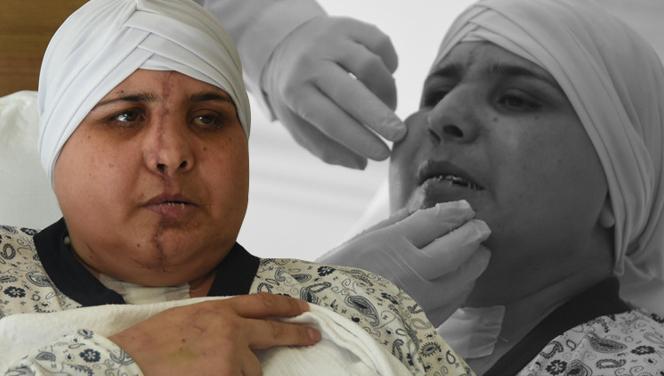 Eskişehir'de inanılmaz olay! İkiye ayrılan yüzü böyle birleştirildi Eskişehir'de inanılmaz olay! İkiye ayrılan yüzü böyle birleştirildi