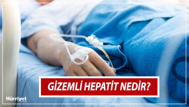 Gizemli Hepatit nedir, belirtileri nelerdir? Gizemli Hepatit Türkiye'de var mı? İşte merak edilenler 