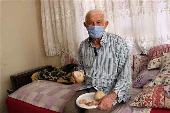 73 yaşındaki hastanın mesanesinden 2 kilo taş çıktı