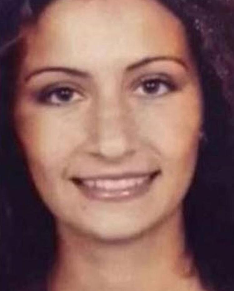 Eski hali bambaşkaydı Estetik operasyon onu öyle değiştirdi ki! Son