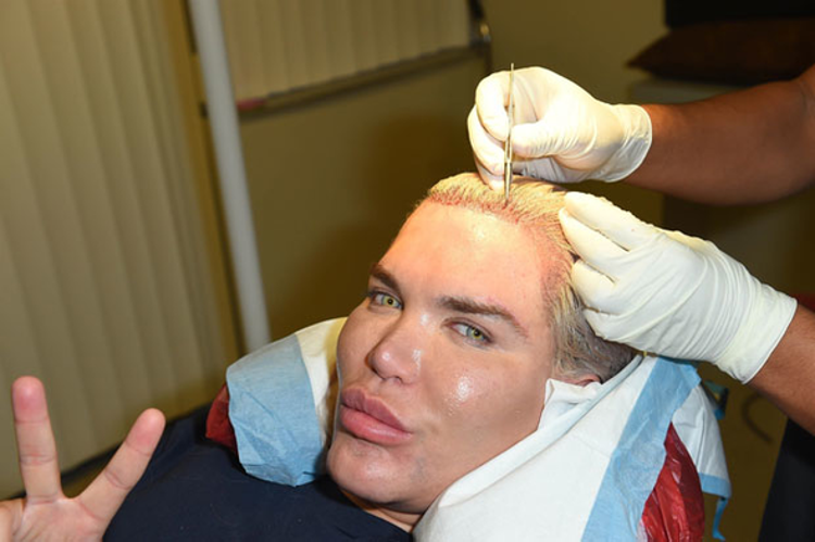 Meger Amaci Ken E Benzemek Degilmis Dunyadan Haberler