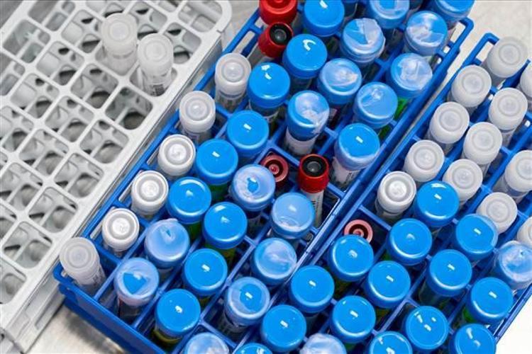İranda Kovid-19 hastalarının yaklaşık dörtte biri ölüm riski taşıyor