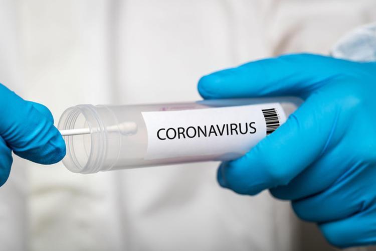COVID19’da hangi test ne kadar güvenilir? PCR ve antikor testleri