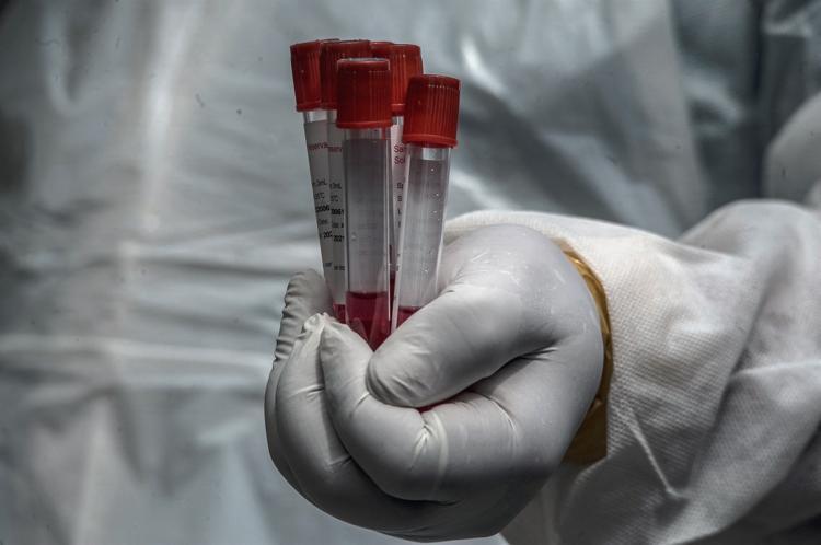 BİR ÇAY KAŞIĞI DÜNYAYA ÇIKTI