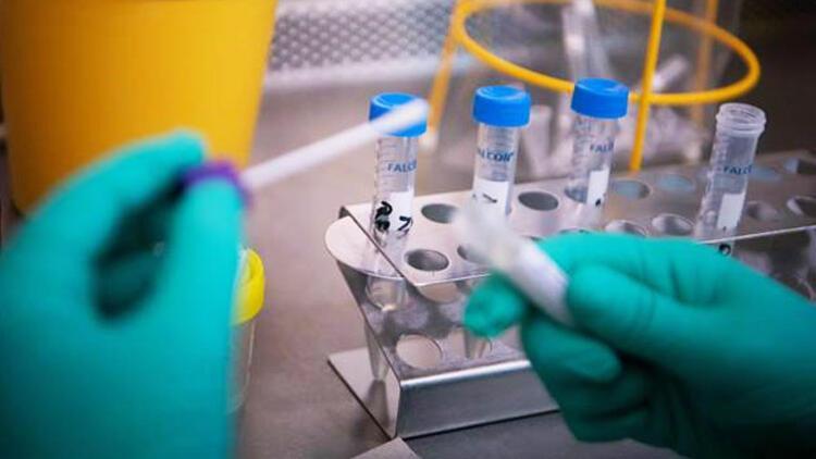 covid testi sonucu ne zaman kac saatte cikar pcr testi kac gunde cikar iste merak edilen sorularin cevaplari son dakika haberler