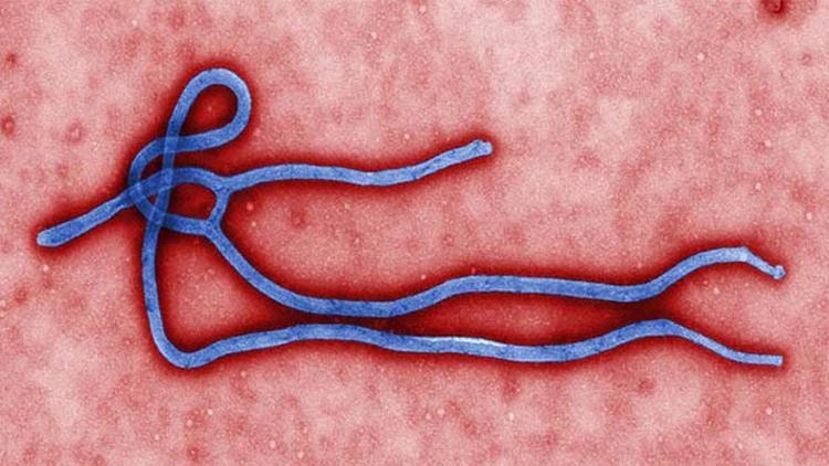 Uzmanlardan Ebola uyarısı