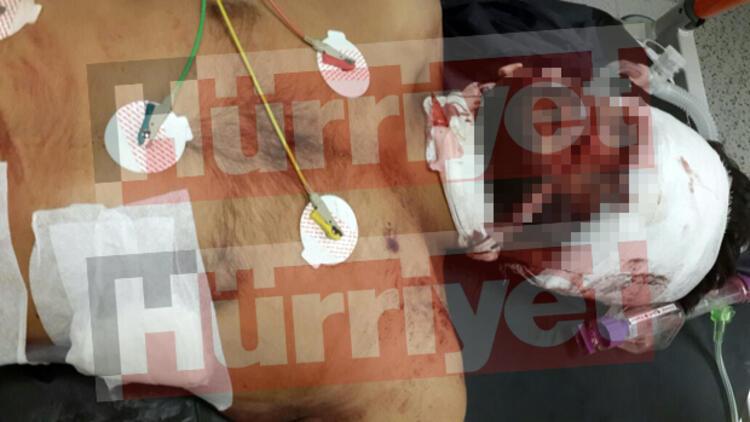 IŞİD üyesi Şanlıurfa’da tedavi ediliyor iddiası