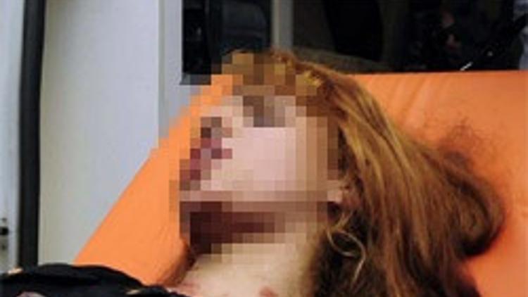 Sultangazi'de silahlı çatışma