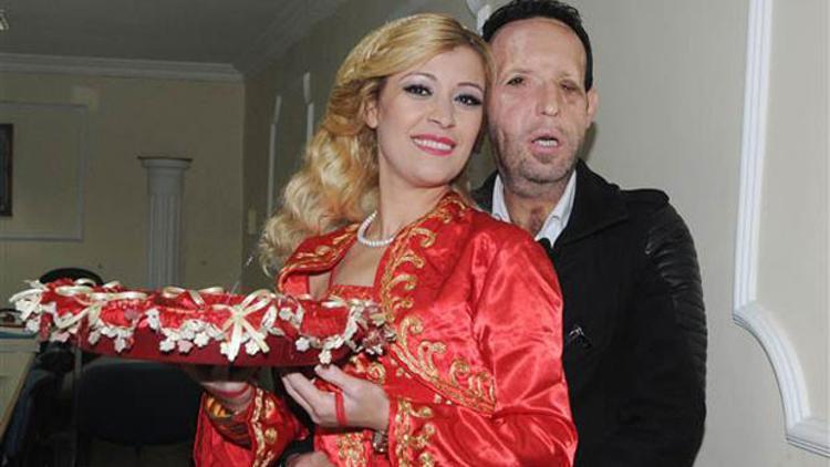 Türkiye’nin 5’inci yüz nakli hastası Recep Sert baba oluyor