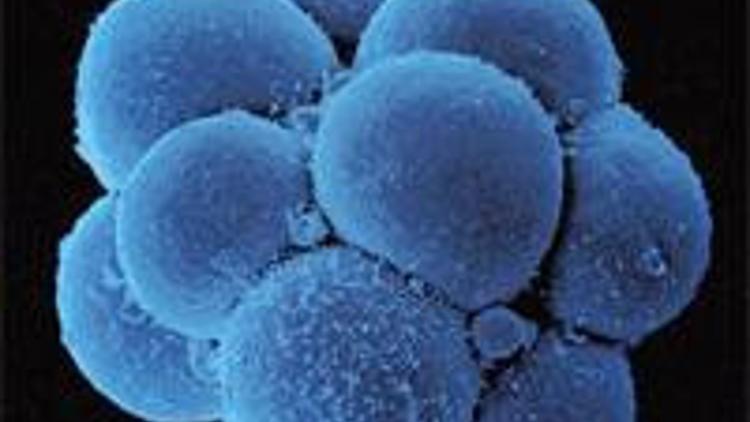 Organ naklinde embriyona gerek bırakmayan yeni yöntem