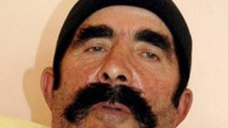 İdrar torbasından yumurta büyüklüğünde taş çıktı