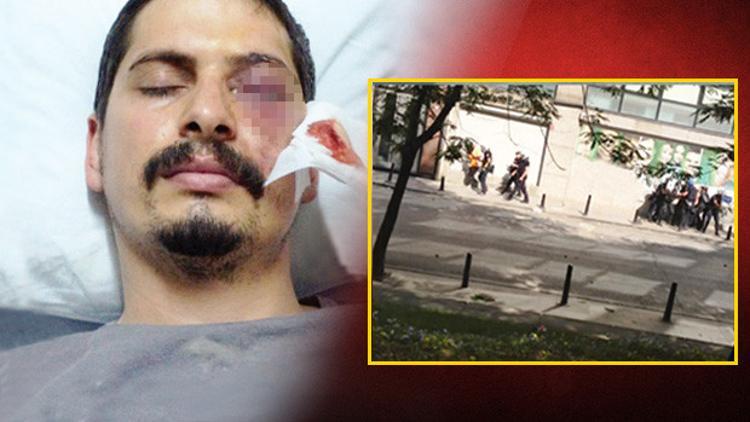 Polis fişeğinin gözünü çıkardığı anı kaydetti
