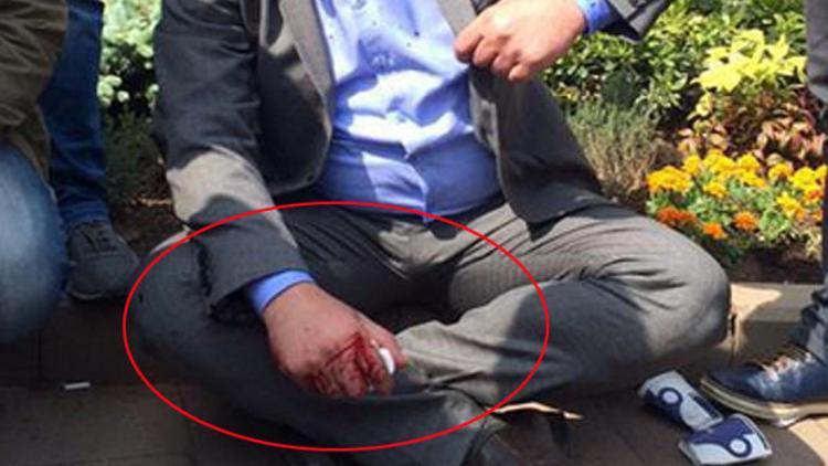 CHP'li vekilin eli kanlar içinde kaldı