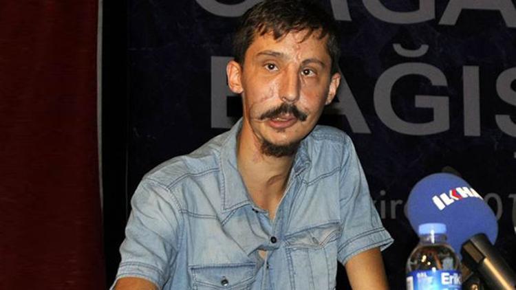 Yüz nakilli Recep'ler organ bağışına çağrı yaptı
