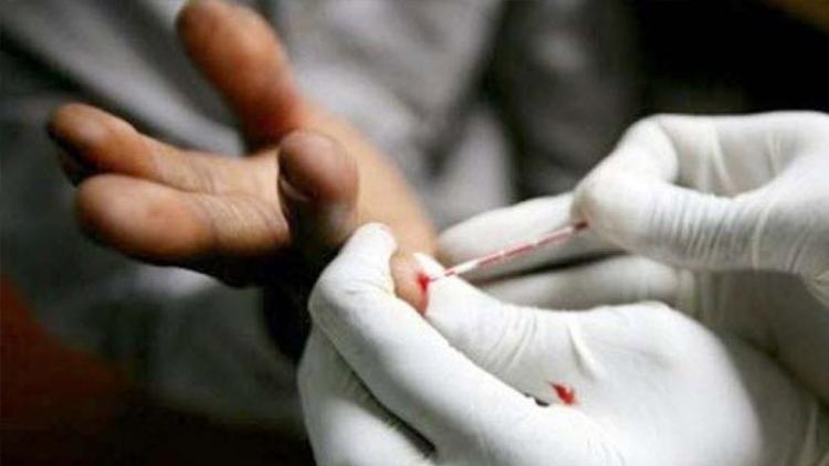 Fransa’da evde AIDS testi satışa çıktı Avrupa Haberleri