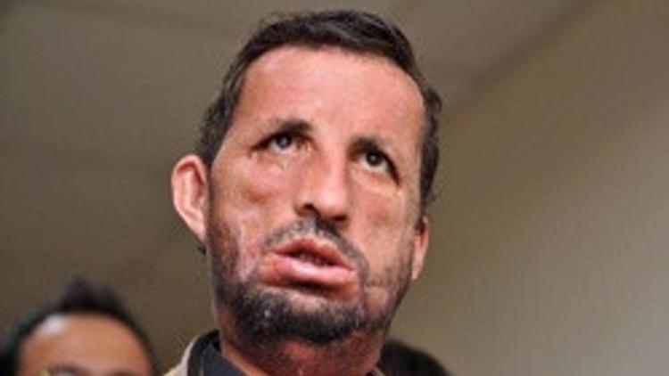 İlk kez basın karşısında