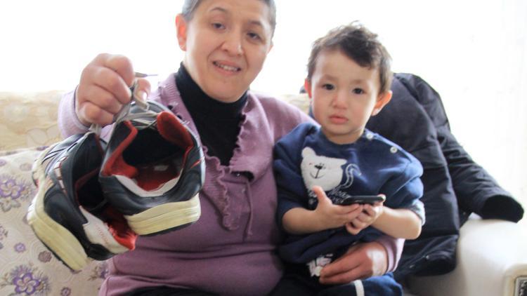 Nazlı Akgül 31 yıl aradan sonra fil hastalığını yendi