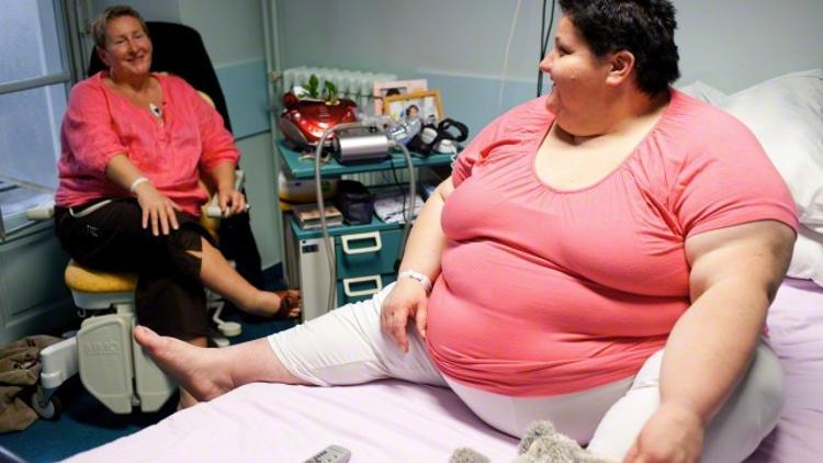 Obezite cerrahisi sonrası yeniden kilo alma sorunu ve revizyonel cerrahi