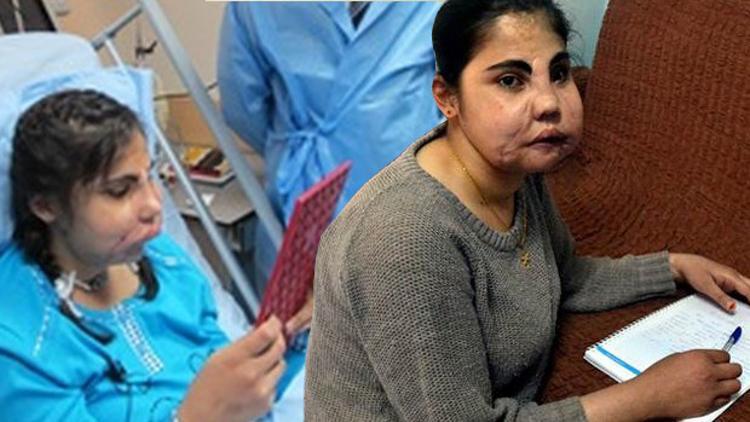 Türkiye'nin yüz nakli yapılan ilk kadını Hatice Nergis öldü