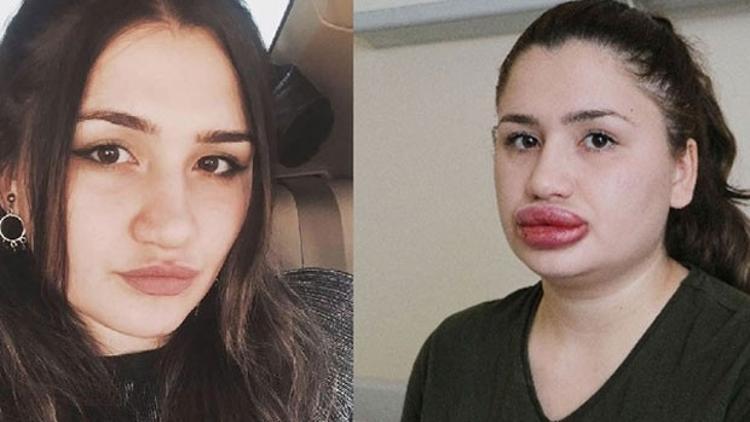 "Sahte estetikçi" kuaför cezaevinden kaçtı