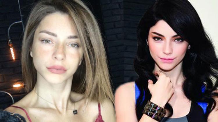 Merve Boluğur estetik mi yaptırdı?