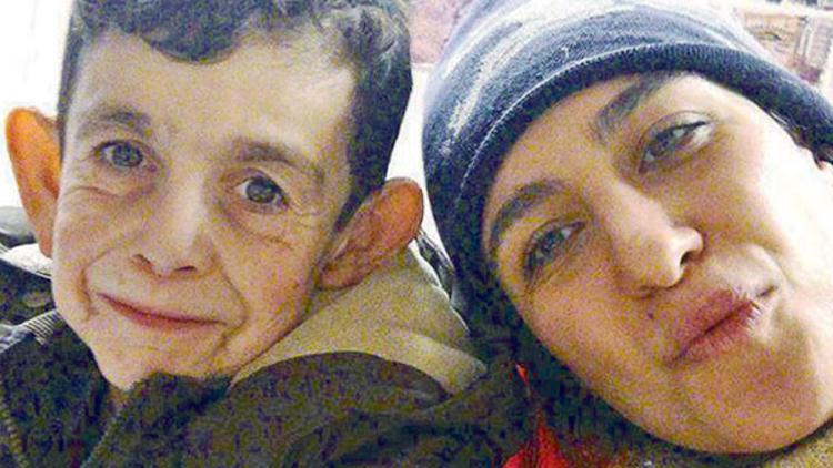 Suriyeli ‘Benjamin Button’ın hayatı bir fotoğrafla nasıl değişti?