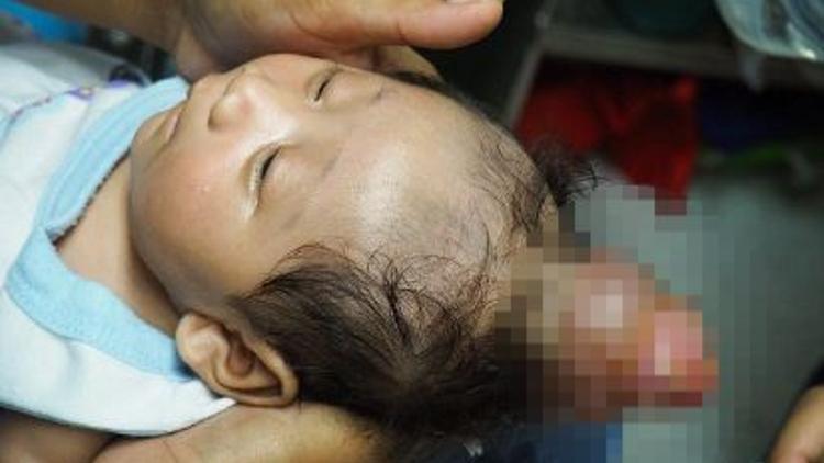 Filipinler'de boynuzlu bebek görenleri şaşkına çevirdi!
