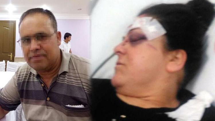 Boşanma davası açan karısına tornavidayla saldırdı