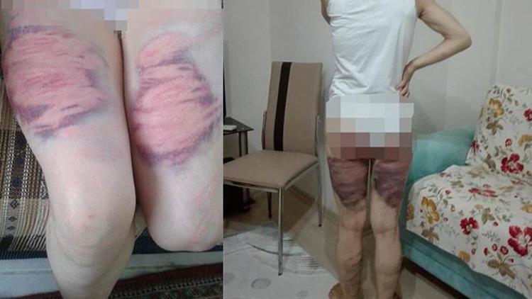 Son dakika Eşini bu hale getirmişti&hellip; Tartışılacak karar