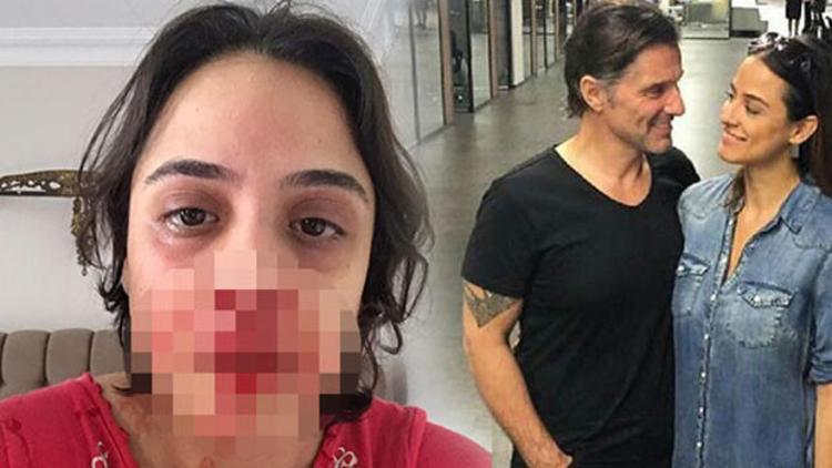 Hazım Körmükçü oynadığı diziden çıkarıldı