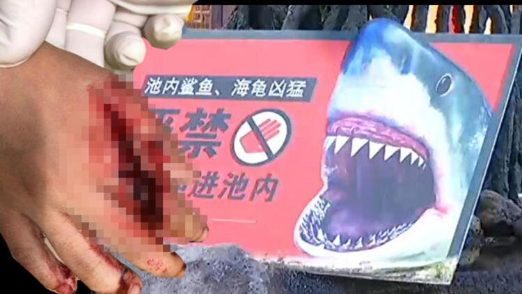 Miamide köpek balığı saldırısı - Sondakika Haberler