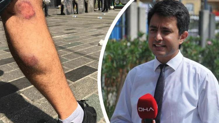DHA muhabirine, görevi sırasında gazlı mermili saldırı
